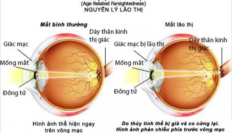 lao-thi-7